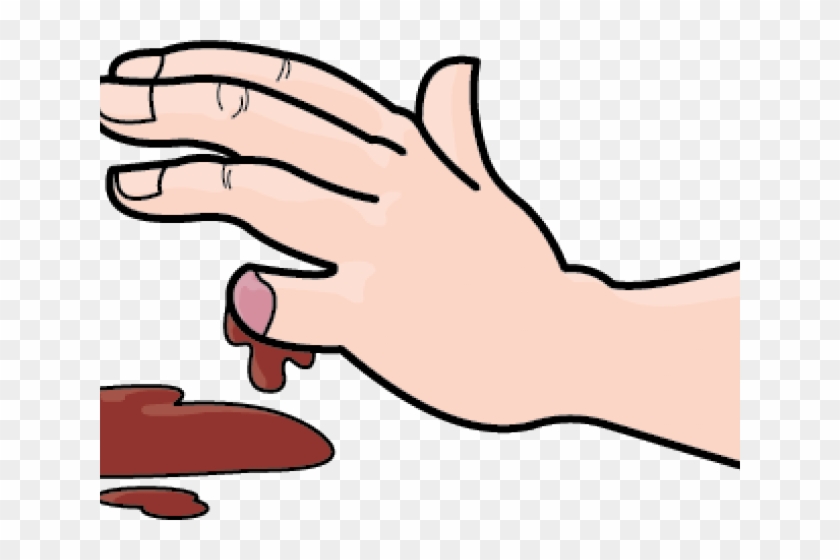 Blood Clipart Blood Loss - Amputation Finger Clipart, HD Png Download ...