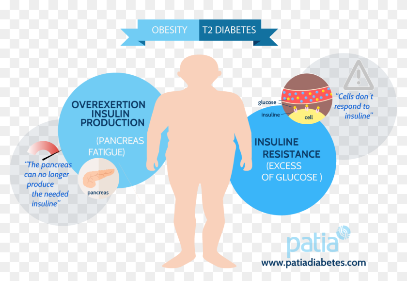 Сахарный диабет 2 типа при ожирении. Ожирение. Obesity and Diabetes. Сахарный диабет ожирение. Obesitydiabetes.